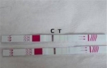 测癌试纸用来检测胰腺癌，价格低廉有效度惊人