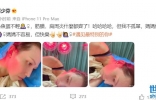 当妈妈不容易，蔡少芬带儿子累出筋膜炎肩周炎，晒针灸照惹人心疼 ...