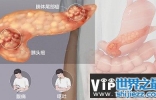 哪些人群最容易患胰腺癌？