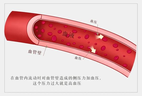 确诊高血压，一定要吃降压药了吗？最靠谱的解释来了…… 