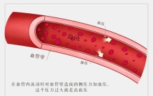 确诊高血压，一定要吃降压药了吗？最靠谱的解释来了……