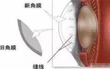 猪皮可以做眼膜吗（可以）